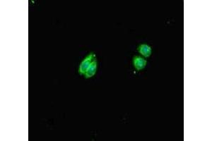 Immunofluorescent analysis of HepG2 cells using ABIN7155018 at dilution of 1:100 and Alexa Fluor 488-congugated AffiniPure Goat Anti-Rabbit IgG(H+L) (HS6ST1 Antikörper  (AA 3-133))