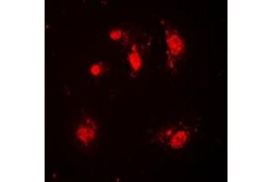Immunofluorescent analysis of SKP2 staining in HeLa cells. (SKP2 Antikörper  (C-Term))