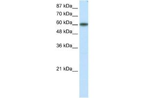 WB Suggested Anti-KLF11 Antibody Titration: 1.