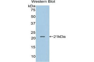 Western Blotting (WB) image for anti-Leukocyte Cell-Derived Chemotaxin 2 (LECT2) (AA 1-151) antibody (ABIN1859639)