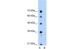 Western Blotting (WB) image for anti-Sep (O-phosphoserine) tRNA:Sec (Selenocysteine) tRNA Synthase (SEPSECS) antibody (ABIN2462350) (SEPSECS Antikörper)