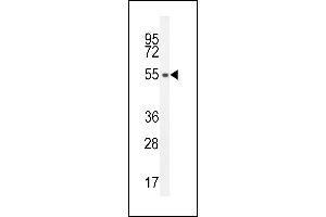 S35E2 Antibody (N-term) (ABIN654754 and ABIN2844438) western blot analysis in HL-60 cell line lysates (35 μg/lane). (SLC35E2 Antikörper  (N-Term))