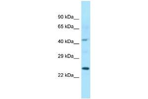 WB Suggested Anti-ISOC1 Antibody Titration: 1. (ISOC1 Antikörper  (C-Term))