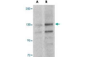Western blot analysis of FRMPD4 in SK-N-SH cell lysate with FRMPD4 polyclonal antibody  at (A) 1 and (B) 2 ug/mL . (FRMPD4 Antikörper  (Internal Region))