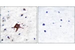 Immunohistochemistry analysis of paraffin-embedded human brain tissue, using GLUT3 Antibody. (SLC2A3 Antikörper  (AA 447-496))