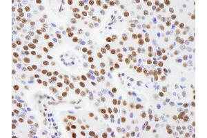 Immunohistochemistry (IHC) image for anti-A Kinase (PRKA) Anchor Protein 8-Like (AKAP8L) (AA 596-646) antibody (ABIN7448929) (AKAP8L Antikörper  (AA 596-646))