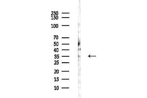 anti-Prostaglandin Reductase 2 (PTGR2) (Internal Region) antibody