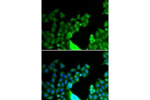Immunofluorescence analysis of HeLa cells using BCL2L14 antibody. (BCL2L14 Antikörper)