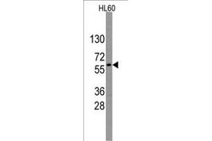 Western blot analysis of anti-GNL3 Antibody (Center) (R) in HL60 cell line lysates (35 μg/lane). (Nucleostemin Antikörper  (AA 191-220))