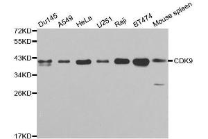 Western blot analysis of extracts of various cell lines, using CDK9 antibody. (CDK9 Antikörper  (AA 153-372))