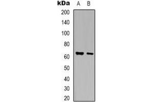 Western blot analysis of Arylsulfatase G expression in HEK293T (A), mouse liver (B) whole cell lysates. (ARSG Antikörper)