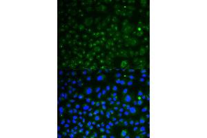 Immunofluorescence analysis of HeLa cell using LAMP1 antibody. (LAMP1 Antikörper  (AA 80-280))