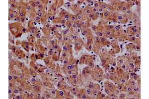 Immunohistochemistry of paraffin-embedded human pancreatic tissue using ABIN7156641 at dilution of 1:100 (MX1 Antikörper  (AA 7-172))