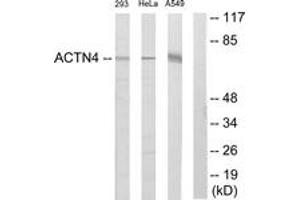 Western blot analysis of extracts from 293/HeLa/A549 cells, using ACTN1/2/3/4 Antibody. (ACTN1/2/3/4 Antikörper  (AA 21-70))