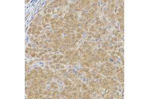 Immunohistochemistry of paraffin-embedded rat ovary using DC Rabbit mAb (ABIN7266685) at dilution of 1:200 (40x lens). (DCAF7 Antikörper)