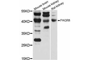Western blot analysis of extracts of various cell lines, using PAQR8 antibody (ABIN5998450) at 1/1000 dilution.
