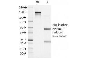 SDS-PAGE Analysis of Purified, BSA-Free Bcl6 Antibody (clone BCL6/1527). (BCL6 Antikörper  (AA 256-389))