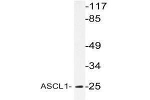 Western blot (WB) analyzes of ASCL1 antibody in extracts from Jurkat cells. (ASCL1 Antikörper)