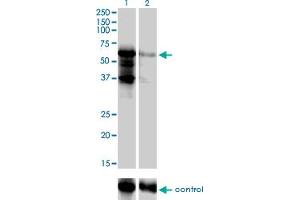 Western blot analysis of PKNOX2 over-expressed 293 cell line, cotransfected with PKNOX2 Validated Chimera RNAi (Lane 2) or non-transfected control (Lane 1). (PKNOX2 Antikörper  (AA 116-215))