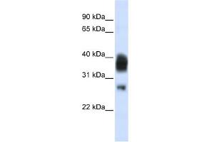 WB Suggested Anti-RNASEH1 Antibody Titration:  0. (Ribonuclease H1 Antikörper  (Middle Region))