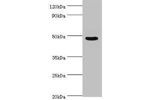 Western blot All lanes: Evolutionarily conserved signaling intermediate in Toll pathway, mitochondrial antibody at 10 μg/mL + Jurkat whole cell lysate Secondary Goat polyclonal to rabbit IgG at 1/10000 dilution Predicted band size: 50, 34, 25 kDa Observed band size: 50 kDa (ECSIT Antikörper  (AA 185-431))