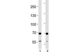 SDHA antibody western blot analysis in 1) human HeLa and 2) mouse C2C12 lysate. (SDHA Antikörper  (AA 577-605))
