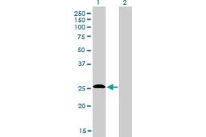Western Blot analysis of C20orf18 expression in transfected 293T cell line by C20orf18 monoclonal antibody (M01), clone 3C3. (RBCK1 Antikörper  (AA 3-99))