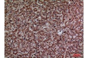 Immunohistochemistry (IHC) analysis of paraffin-embedded Human Liver, antibody was diluted at 1:100. (CEACAM1/5 Antikörper  (N-Term))