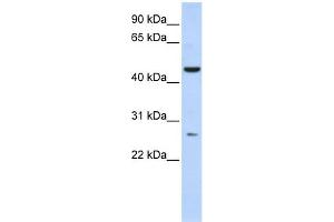 WB Suggested Anti-C6orf199 Antibody Titration: 0. (AKD1 Antikörper  (Middle Region))