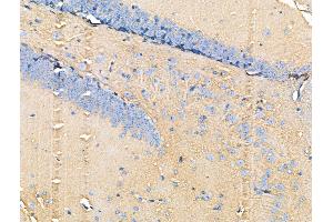 ABIN6259937 and ABIN6266496 at 1/100 staining Mouse brain tissue by IHC-P. (ANXA6 Antikörper  (N-Term))