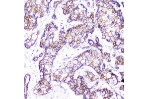 Immunohistochemistry (IHC) image for anti-Catenin, beta (CATNB) (AA 2-233) antibody (ABIN6654150)