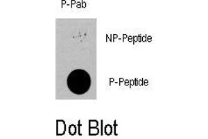 Image no. 1 for anti-3-phosphoinositide Dependent Protein Kinase-1 (PDPK1) (pSer396) antibody (ABIN358390)