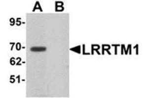 Western blot analysis of LRRTM1 in mouse brain tissue lysate with LRRTM1 antibody at 1 μg/ml in (A) the absence and (B) the presence of blocking peptide.