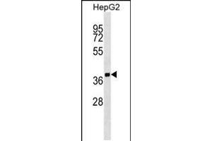 Western blot analysis in HepG2 cell line lysates (35ug/lane). (SCAMP2 Antikörper  (AA 119-147))