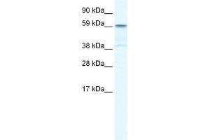 Human Liver; WB Suggested Anti-TRIM41 Antibody Titration: 0. (TRIM41 Antikörper  (C-Term))