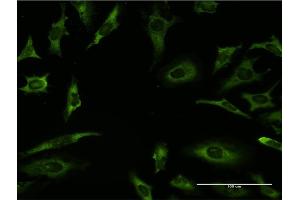 Immunofluorescence of monoclonal antibody to RARA on HeLa cell.