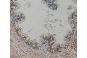 IHC-P analysis of prostate gland tissue, with DAB staining. (PSMA Antikörper  (AA 536-752))
