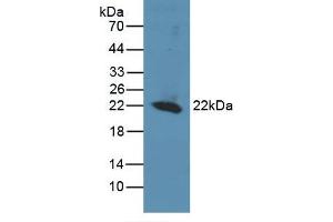 Detection of Recombinant REV1, Human using Polyclonal Antibody to REV1 Homolog (REV1) (REV1 Antikörper  (AA 301-478))