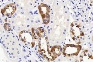 Immunohistochemistry analysis of paraffin-embedded human kidney using Endostatin (ABIN7073823) at dilution of 1:1200