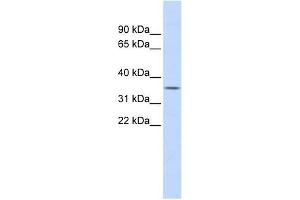 FCN1 antibody used at 1 ug/ml to detect target protein. (FCN1 Antikörper)