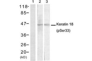 Western blot analysis of extracts from A431 cells (Lane 1 and 2) and EC-304 cells (Lane 3) using Keratin 18 (Phospho-Ser33) antibody (E011306). (Cytokeratin 18 Antikörper  (pSer33))