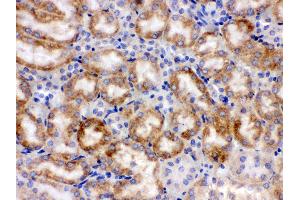 Immunohistochemistry (IHC) image for anti-Cytochrome P450, Family 1, Subfamily A, Polypeptide 1 (CYP1A1) (AA 183-320) antibody (ABIN3043819)