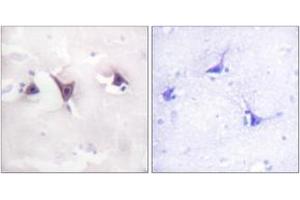 Immunohistochemistry analysis of paraffin-embedded human brain tissue, using Trk B (Ab-515) Antibody. (TRKB Antikörper  (AA 481-530))