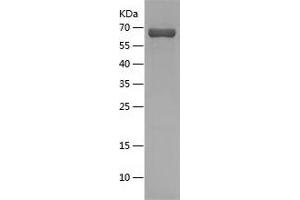 Western Blotting (WB) image for Cystathionase (Cystathionine gamma-Lyase) (CTH) (AA 1-405) protein (His-IF2DI Tag) (ABIN7122547)