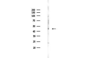 anti-Calcium Binding tyrosine-(Y)-phosphorylation Regulated (CABYR) (Internal Region) antibody
