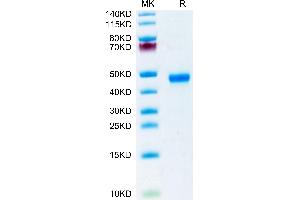 Mouse R spondin 1/RSPO1 on Tris-Bis PAGE under reduced condition. (RSPO1 Protein (AA 21-265) (His tag))