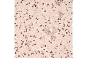 Immunohistochemistry of paraffin-embedded mouse brain using EHMT2 Rabbit mAb (ABIN7265616) at dilution of 1:100 (40x lens). (EHMT2 Antikörper)