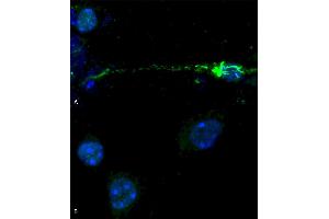 Phospho serine 129 antibody (ABIN5650947) was used to detect phosphorylated alpha synuclein in primary mouse hippocampal neurons treated with 100 nM sonicated mouse alpha synuclein PFFs (ABIN5651245) (A). (SNCA Antikörper  (pSer129) (Biotin))