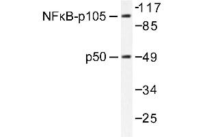 Image no. 1 for anti-Nuclear Factor of kappa Light Polypeptide Gene Enhancer in B-Cells 1 (NFKB1) antibody (ABIN271742) (NFKB1 Antikörper)