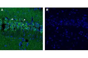 Free-floating frozen brain sections from a paraformaldehyde-perfused mouse were incubated with Anti-Synaptojanin 1 antibody (ABIN7885553, 1:300), followed by goat anti-rabbit secondary antibody conjugated to Alexa Fluor® 488 (green).